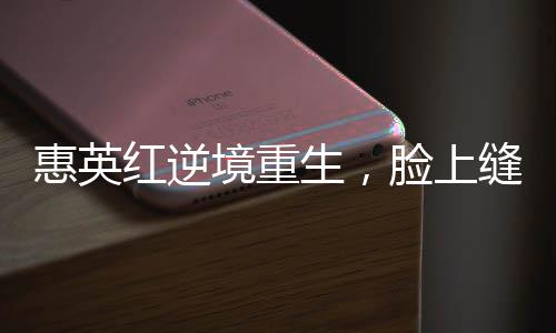 惠英紅逆境重生，臉上縫了89針的堅(jiān)韌故事