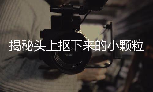 揭秘頭上摳下來的小顆粒，成因、影響與應(yīng)對(duì)之道