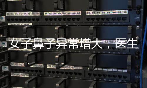 女子鼻子異常增大，醫(yī)生迅速察覺不尋?，F象